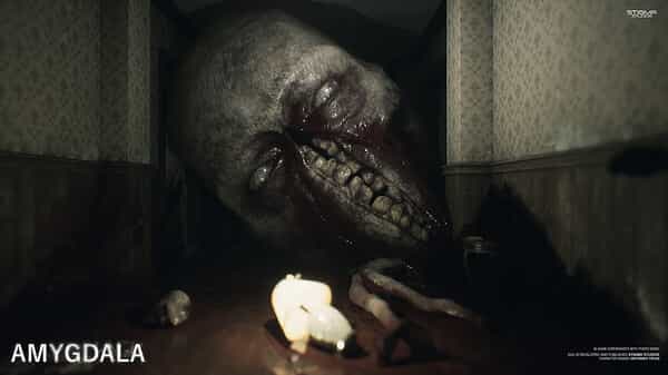 amygdala