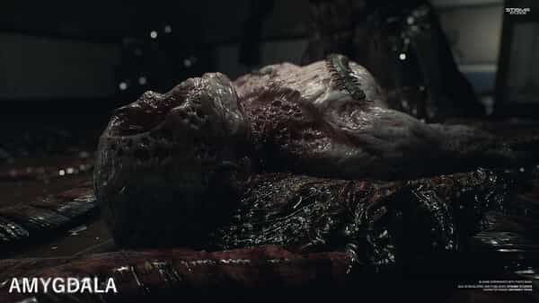 amygdala